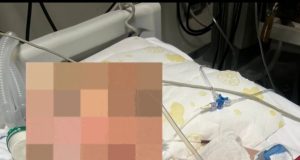 U plagos me thikë nga bashkëmoshatari në Durrës, humb jetën 15-vjeçari