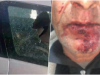 Tmerrohet familja në Durrës/ Sulm brutal, kemi frike të dalim dhe për të blerë bukë, autorët ende të lirë