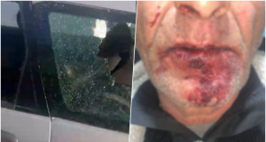 Tmerrohet familja në Durrës/ Sulm brutal, kemi frike të dalim dhe për të blerë bukë, autorët ende të lirë