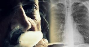 Studim alarmant/ Tymi nga cigaret elektronike dëmton seriozisht mushkëritë
