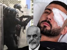 Plagosja në sy e Erjon Vishkullit, reagojnë Demokratët Evropianë: Kërkojmë hetim të pavarur dhe llogaridhënie