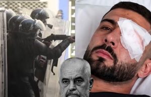 Plagosja në sy e Erjon Vishkullit, reagojnë Demokratët Evropianë: Kërkojmë hetim të pavarur dhe llogaridhënie